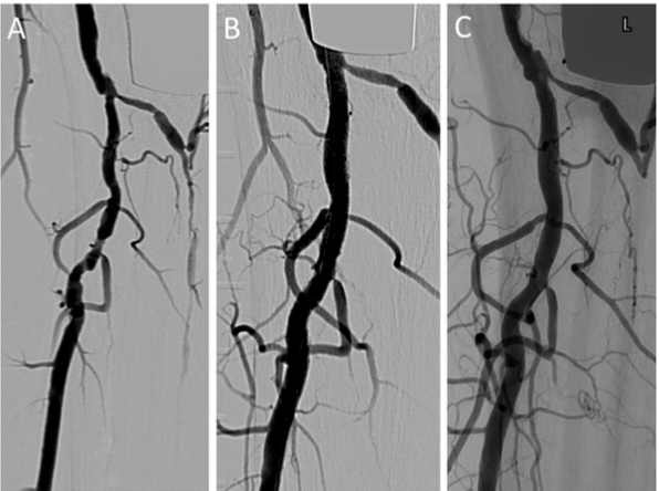 Figure 2. An angiographic image