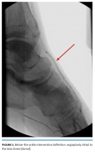 BTA Interventions for CLTI Fig 1
