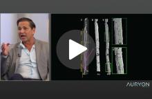Exploring the Auryon System's dual impact on severe calcium below the knee, with Dr. John Rundback and Dr. Bulent Arslan
